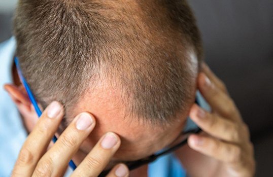 Hair Loss and Hair Fall Treatment | Elation