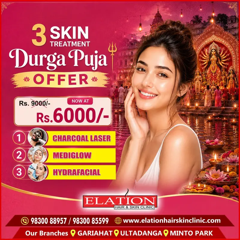 Elation 3 Skin Puja Offer Elation 3 Skin Puja Offer
