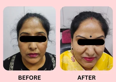 Treatment Result