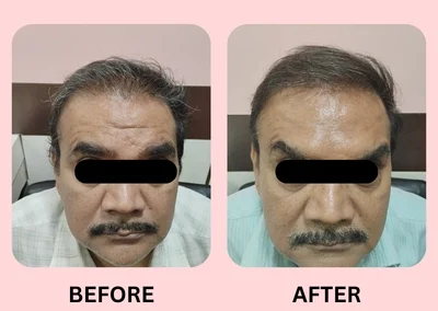 Treatment Result