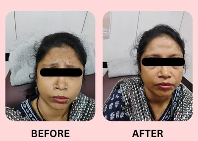 Treatment Result