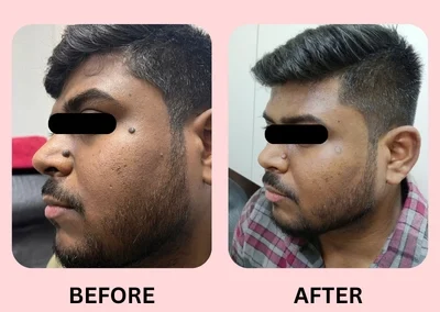 Treatment Result